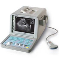 SIUI CTS-485 portable ultrasound