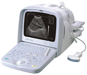 CTS5500 Portable Ultrasound