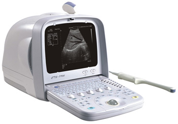CTS7700 Ultrasound