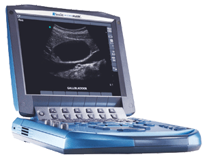 SonoSite MicroMaxx